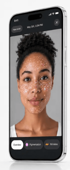 Skin analysis — pigmentation